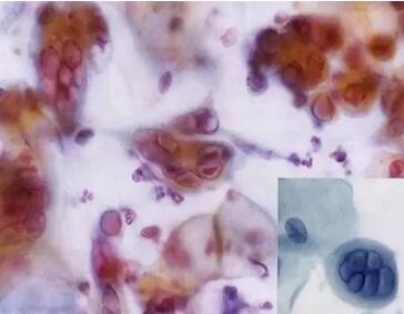 ���(l��i)ϴ���ӣ��������ךW���M(j��n)�ھ�ϴ�O(sh��)���ꑌ�������Ҽ�